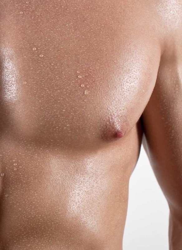 Jinekomasti (Erkekte Meme Büyümesi)