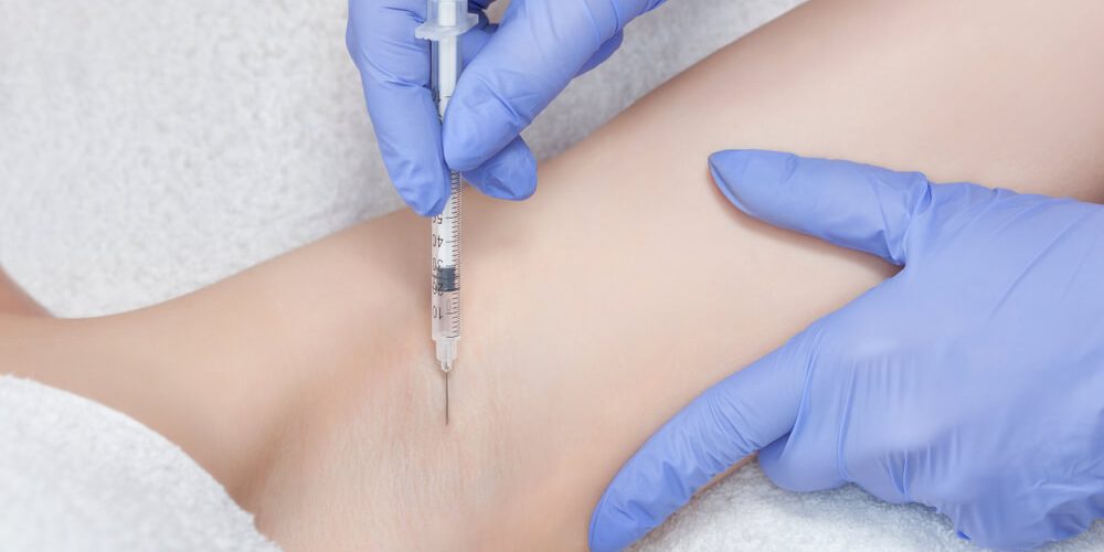 Koltuk Altı Botoksu (Terleme Tedavisi)